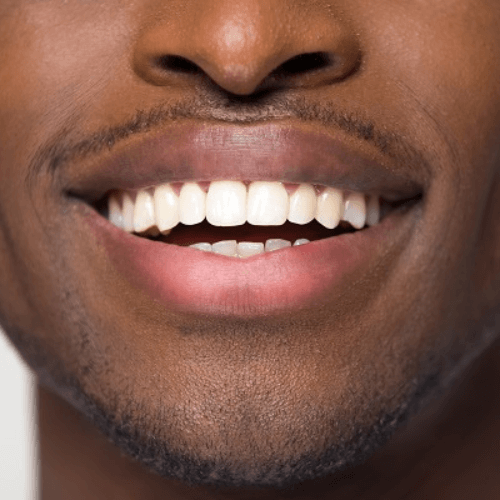 man with straight white teeth after treatment in manchester