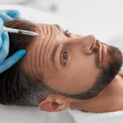 man receiving dermal fillers in forehead wrinkles