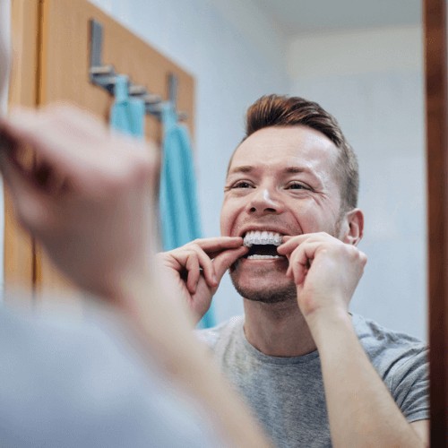 Man looking in the mirror putting his invisalign aligners in.