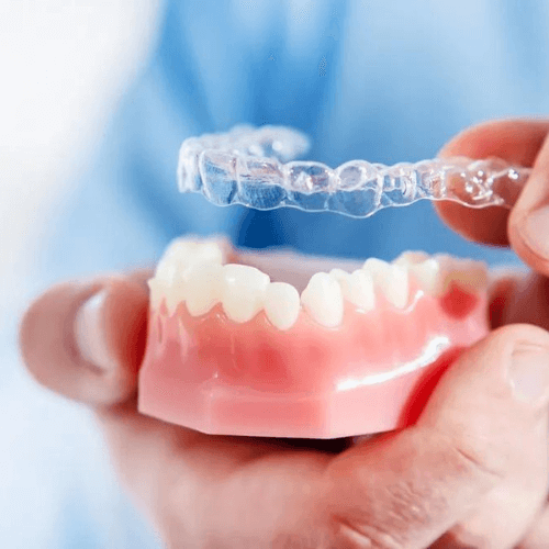 invisalign shown going on a dental model