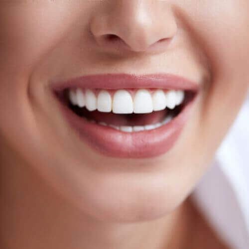Common Concerns That Clear Braces Can Fix (Invisalign Stockport, manchester)