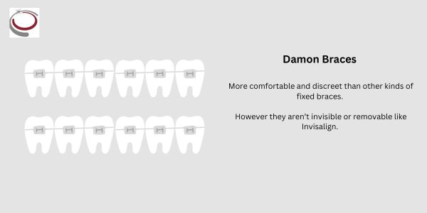 damon braces infographic. more comfortable and discreet than any other kinds of fixed braces however they aren't invisible or removable like invisalign clear braces. (Invisalign manchester)