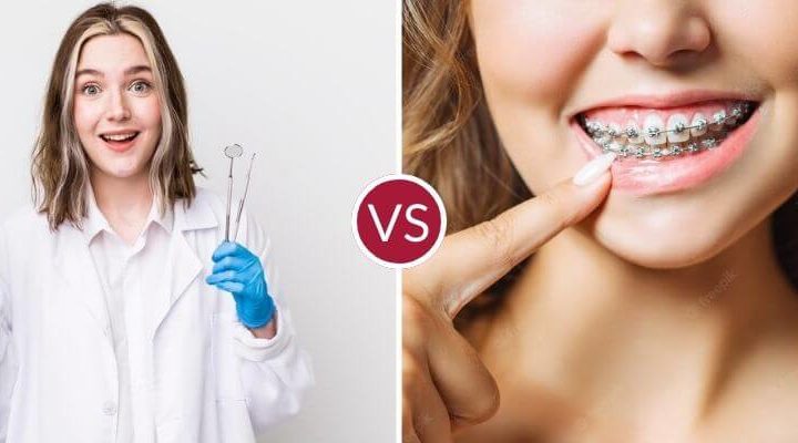 dentist vs orthodontist heaton mersey