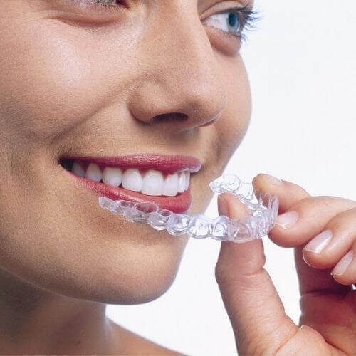 Is Invisalign The Best Clear Brace?