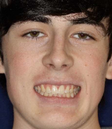 after image of dental procedure