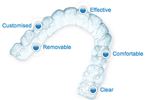 invisalign pros infographic effective clear removable comfortable customisable