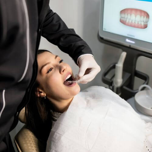 Woman undergoing the beginning of her clear braces journey with us at Heaton Mersey Orthodontic Centre.